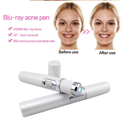 Blue Light Therapy Acne Laser Pen janaila