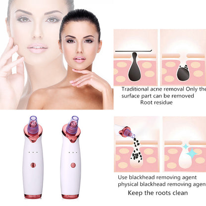 Blackhead Remover Pore Vacuum janaila