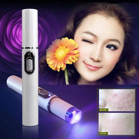 Blue Light Therapy Acne Laser Pen janaila