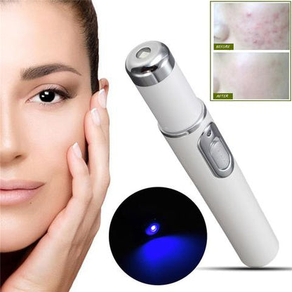 Blue Light Therapy Acne Laser Pen janaila